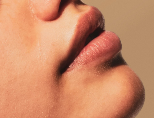 Lifting des lèvres : comment sublimer son sourire ?