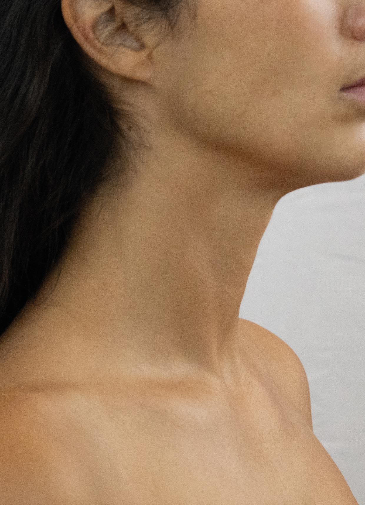 Neck liposuction