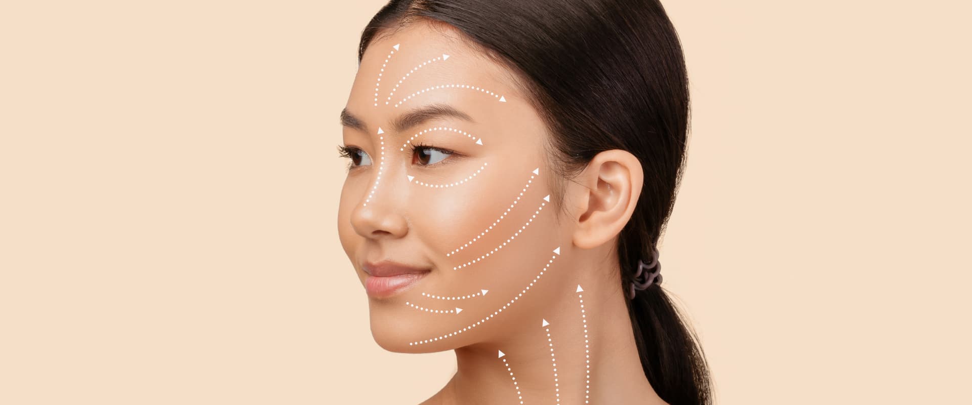 Frau mit Pfeilen im Gesicht zur Vorbereitung eines Facelift in Zürich