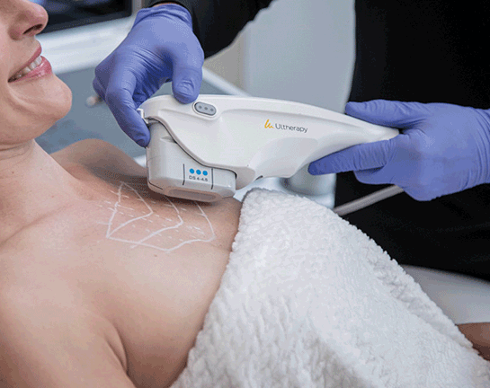 Ultherapy PRIME®